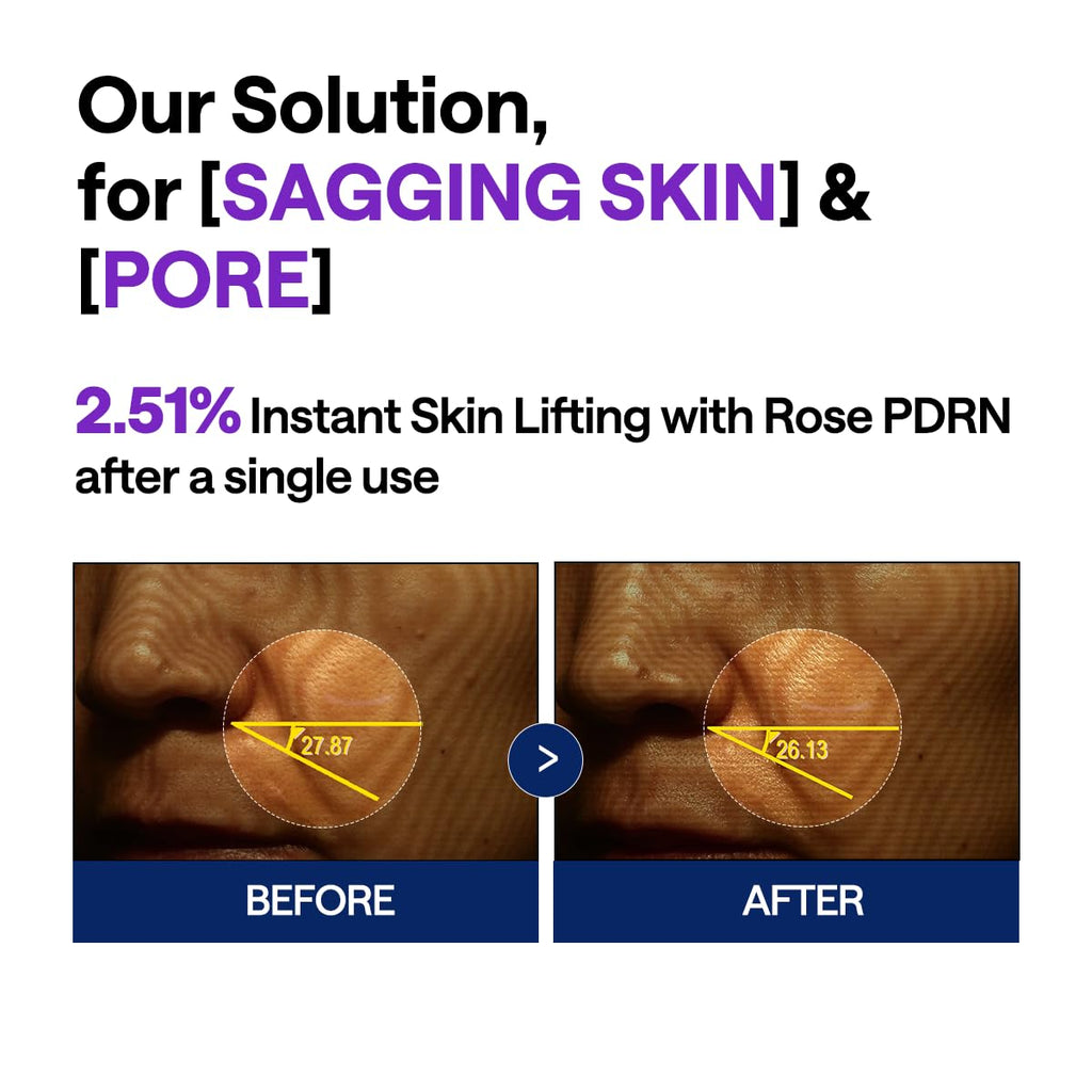 Mediheal PDRN Lifting Serum